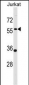 PANX1 Antibody (Center)